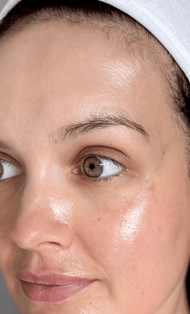 Vitamin-C-Peeling, IG @skincarebyjoanne | Treatwell